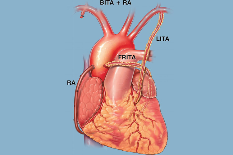 Medixi